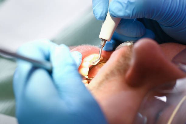 Best Cracked Tooth Emergency Dentist  in Park View, IA