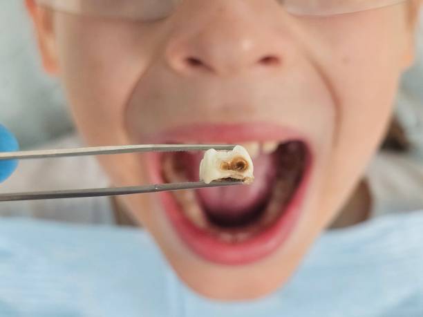 Best Tooth Pain Emergency Relief  in Park View, IA