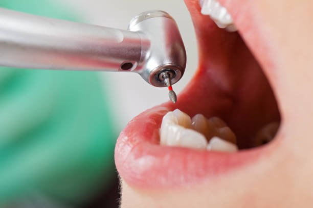 Emergency Dentist Open Today in IA